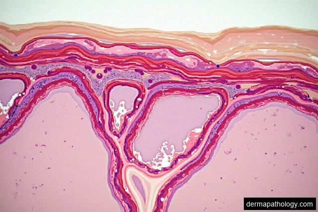Expert Dermatopathologists